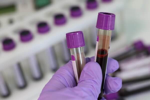 badania laboratoryjne